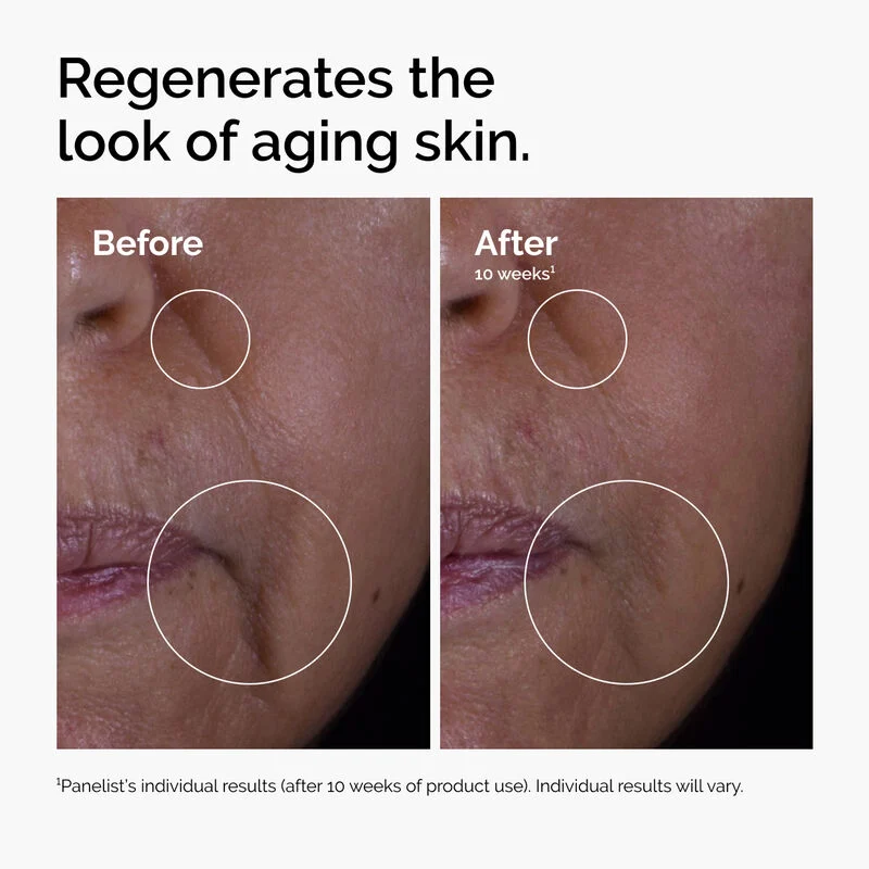 The Ordinary GF 15% Solution 30ml - Image 3
