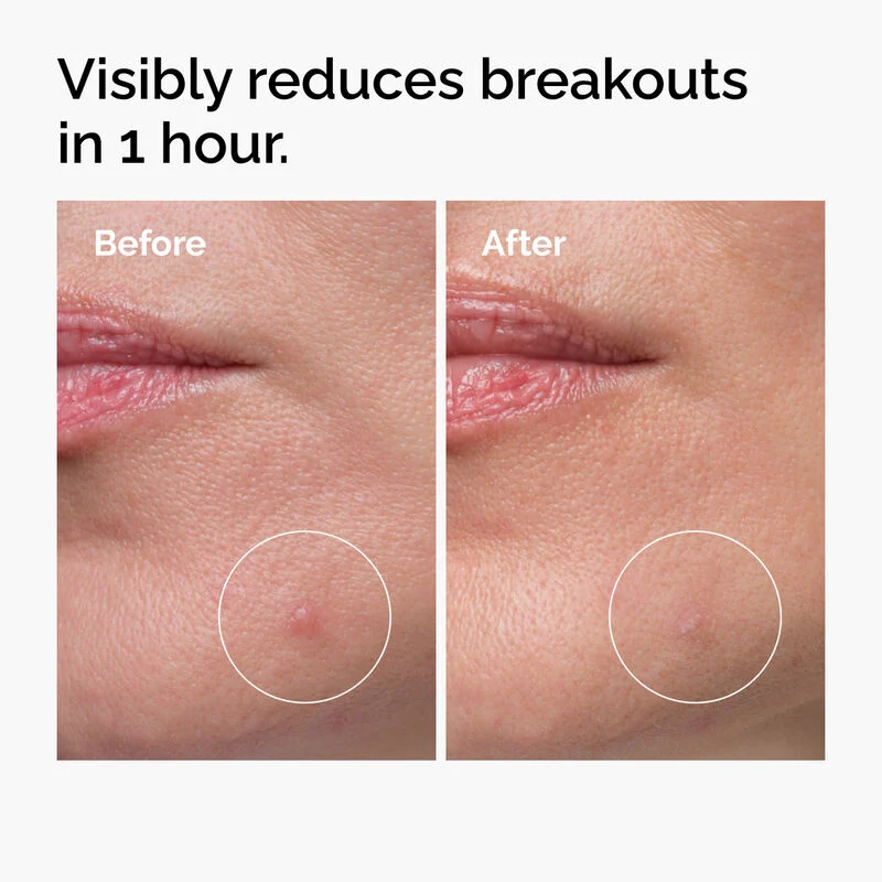 The Ordinary Sulfur 10% Powder-to-Cream Concentrate 5g - Image 3