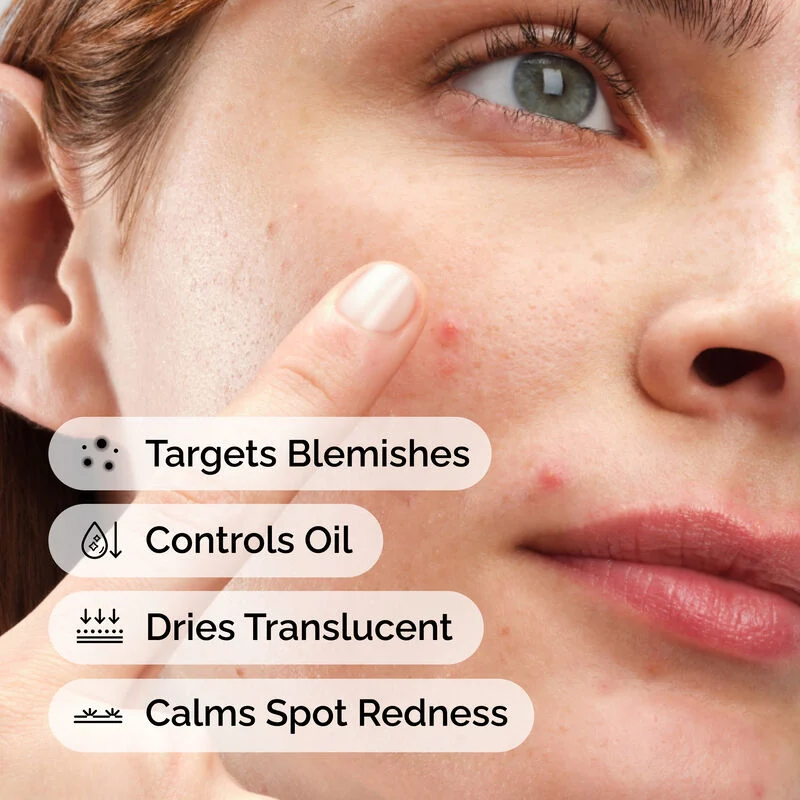 The Ordinary Sulfur 10% Powder-to-Cream Concentrate 5g - Image 5